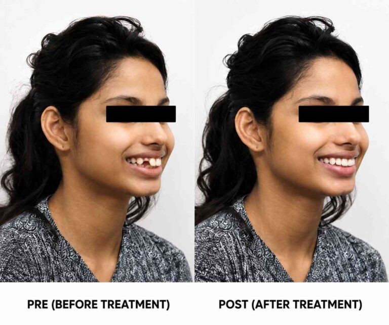 Smile Correction Results